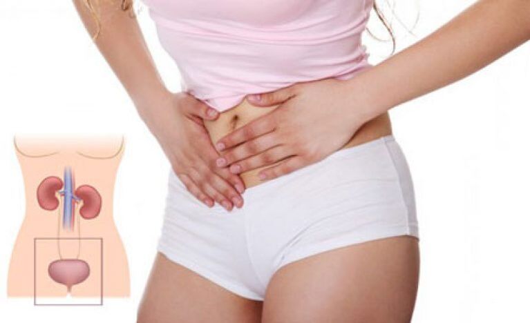 Uno de los síntomas de la cistitis en la mujer es el dolor en la zona suprapúbica.